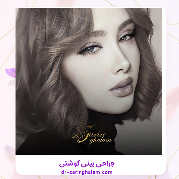 عمل بینی گوشتی - دکتر زرین قلم
