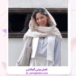 جراحی بینی گوشتی در مشهد - دکتر زرین قلم 