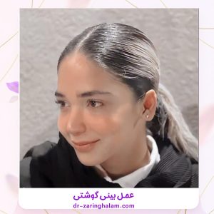 جراحی بینی گوشتی در مشهد - دکتر زرین قلم 