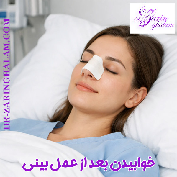 خوابیدن بعد از عمل بینی - دکتر زرین قلم