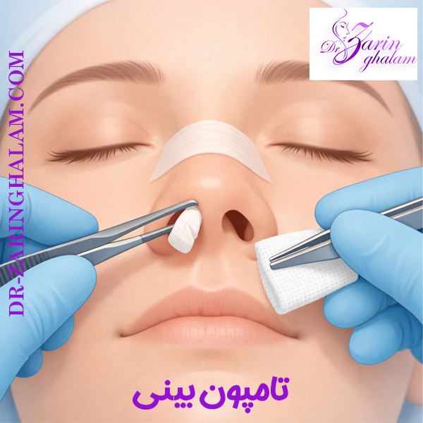 کشیدن تامپون بینی - دکتر زرین قلم