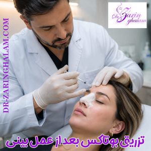 تزریق بوتاکس بعد از عمل بینی - دکتر زرین قلم