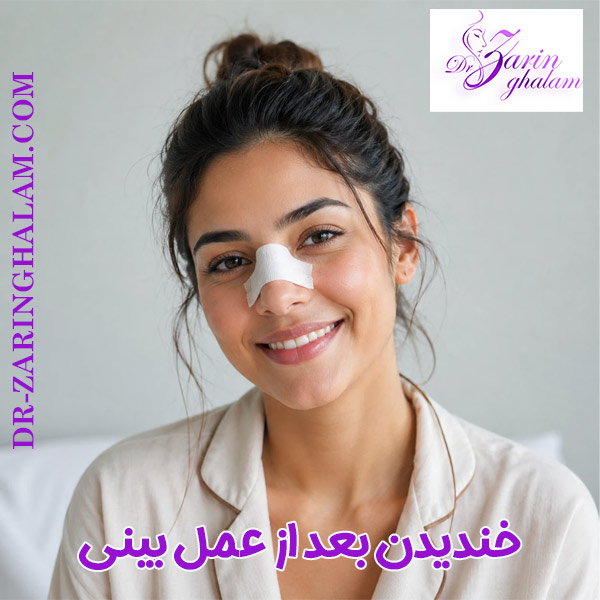 خندیدن بعد از عمل بینی - دکتر زرین قلم