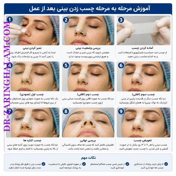 چسب زدن بینی بعد از عمل - دکتر زرین قلم
