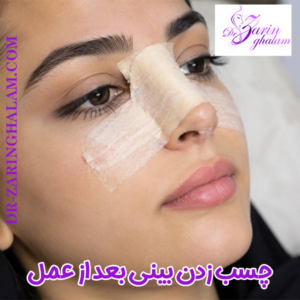 چسب زدن بینی بعد از عمل - دکتر زرین قلم