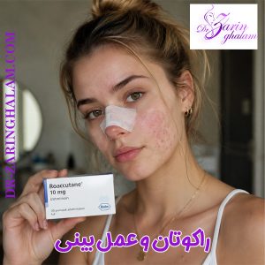 راکوتان و عمل بینی - دکتر زرین قلم