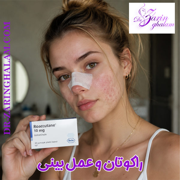 راکوتان و عمل بینی - دکتر زرین قلم